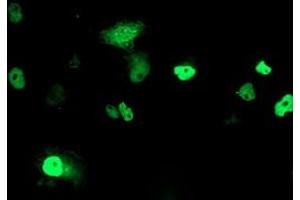 Anti-PHF21B mouse monoclonal antibody (ABIN2454802) immunofluorescent staining of COS7 cells transiently transfected by pCMV6-ENTRY PHF21B (RC204284). (PHF21B 抗体)