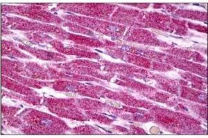 Human Heart: Formalin-Fixed, Paraffin-Embedded (FFPE) (COX7A2 抗体  (N-Term))