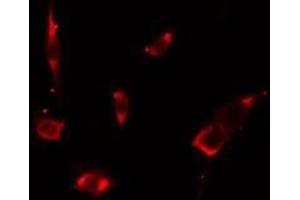 ABIN6275670 staining LOVO cells by IF/ICC. (VPS26B 抗体  (Internal Region))