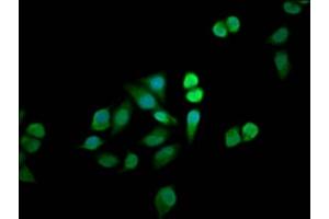 Immunofluorescence staining of Hela cells with ABIN7160633 at 1:33, counter-stained with DAPI. (MTMR12 抗体  (AA 188-318))