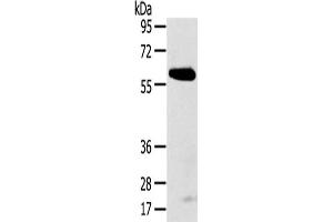 Gel: 8 % SDS-PAGE,Lysate: 40 μg,Primary antibody: ABIN7192624(SPATA18 Antibody) at dilution 1/250 dilution,Secondary antibody: Goat anti rabbit IgG at 1/8000 dilution,Exposure time: 5 minutes (SPATA18 抗体)