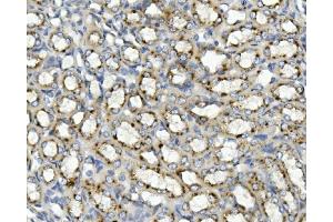 IHC analysis of ASAH1 using anti-ASAH1 antibody (ABIN7602206). (ASAH1 抗体  (AA 63-393))