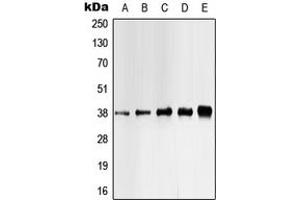 Western blot analysis of CK1 alpha (pY321) expression in HEK293T UV-treated (A), Jurkat (B), K562 (C), mouse liver (D), H9C2 UV-treated (E) whole cell lysates. (CSNK1A1 抗体  (C-Term, pTyr321))