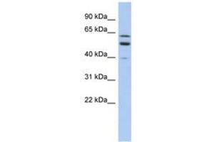Image no. 1 for anti-Transmembrane and Coiled-Coil Domain Family 1 (TMCC1) (AA 431-480) antibody (ABIN6743328) (TMCC1 抗体  (AA 431-480))