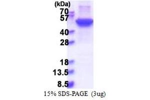 KRT17 Protein (AA 1-432) (His tag)