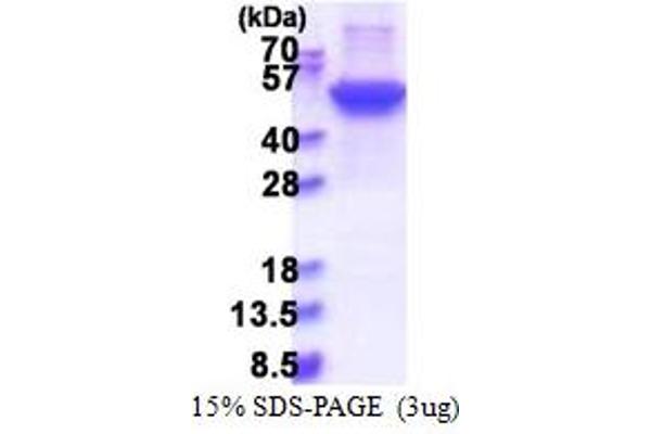 KRT17 Protein (AA 1-432) (His tag)