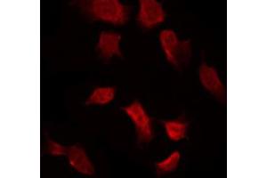 ABIN6267632 staining 293 by IF/ICC. (AMPK alpha 抗体  (pThr172))