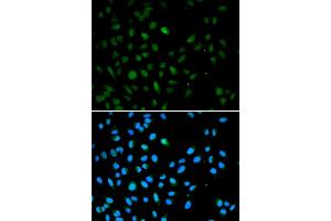 Immunofluorescence analysis of A549 cells using EZH1 antibody (ABIN5973432). (EZH1 抗体)
