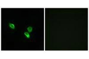Immunofluorescence analysis of MCF-7 cells, using MRPS18C antibody. (MRPS18C 抗体)