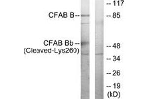 Western Blotting (WB) image for anti-Complement Factor B (CFB) (AA 241-290), (Cleaved-Lys260) antibody (ABIN2891191) (Complement Factor B 抗体  (Cleaved-Lys260))