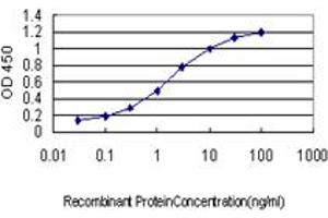 Detection limit for recombinant GST tagged CRYM is approximately 0. (CRYM 抗体  (AA 215-314))