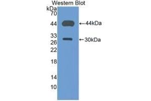 Detection of Recombinant CD4, Mouse using Polyclonal Antibody to Cluster Of Differentiation 4 (CD4) (CD4 抗体  (AA 27-394))