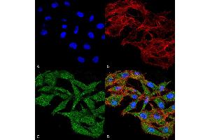 Immunocytochemistry/Immunofluorescence analysis using Rabbit Anti-WDFY3 Polyclonal Antibody . (WDFY3 抗体  (AA 533-544))