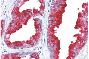 anti-Acid Phosphatase, Prostate (ACPP) antibody