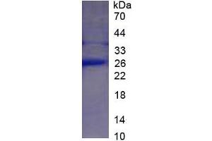 SDS-PAGE of Protein Standard from the Kit (Highly purified E. (CRP ELISA 试剂盒)