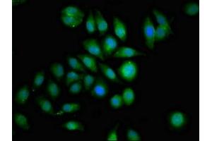 Immunofluorescence staining of A549 cells with ABIN7154498 at 1:100, counter-stained with DAPI. (GRB14 抗体  (AA 294-397))