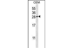 Western blot analysis in CEM cell line lysates (35ug/lane). (PLGF 抗体  (AA 120-148))