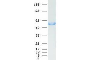 Western Blotting (WB) image for Dopa Decarboxylase (Aromatic L-Amino Acid Decarboxylase) (DDC) (Transcript Variant 1) protein (Myc-DYKDDDDK Tag) (ABIN2714251)