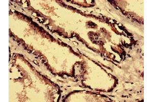 Immunohistochemistry analysis of human prostate tissue using ABIN7148523 at dilution of 1:100 (Copine IV 抗体  (AA 1-280))