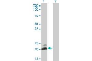 Western Blot analysis of HAND2 expression in transfected 293T cell line by HAND2 monoclonal antibody (M10), clone 3F10. (HAND2 抗体  (AA 135-216))