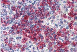 Human Spleen (formalin-fixed, paraffin-embedded) stained with NCOA3 antibody ABIN462179 followed by biotinylated goat anti-rabbit IgG secondary antibody ABIN481713, alkaline phosphatase-streptavidin and chromogen. (NCOA3 抗体  (AA 576-625))