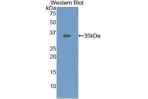 Western blot analysis of recombinant Rat LOX1. (OLR1 抗体  (AA 51-314))