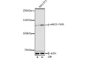 Western blot analysis of extracts of NIH/3T3 cells, using Phospho-eNOS-T495 antibody (ABIN6135215, ABIN6136066, ABIN6136067 and ABIN6225549) at 1:1000 dilution. (ENOS 抗体  (pThr495))