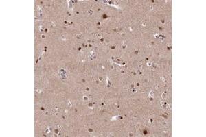 Immunohistochemical staining of human cerebral cortex with MCF2L2 polyclonal antibody  shows strong nuclear positivity in neuronal cells at 1:20-1:50 dilution.