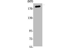 Western Blot analysis of K562, cells using Phospho-Tensin-1 (Y1326) Polyclonal Antibody (Tensin 1 抗体  (pTyr1326))