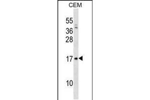 Western blot analysis in CEM cell line lysates (35ug/lane). (VPREB1 抗体  (AA 71-99))