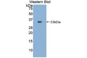 Western Blotting (WB) image for anti-Pyridoxal Kinase (PDXK) (AA 29-285) antibody (ABIN1860179) (PDXK 抗体  (AA 29-285))