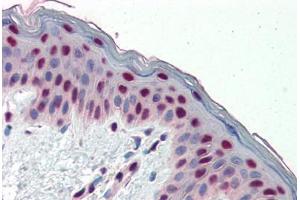 Human Skin (formalin-fixed, paraffin-embedded) stained with FOSL1 antibody ABIN462165 followed by biotinylated goat anti-rabbit IgG secondary antibody ABIN481713, alkaline phosphatase-streptavidin and chromogen. (FOSL1 抗体  (AA 130-179))