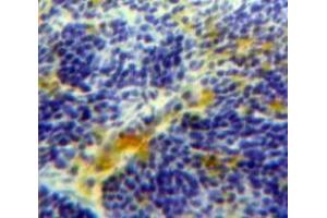 IHC-P analysis of Spleen tissue, with DAB staining. (FCN1 抗体  (AA 45-249))