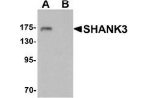 Western blot analysis of SHANK3 in 3T3 cell lysate with SHANK3 antibody at 1 ug/ml in (A) the absence and (B) the presence of blocking peptide. (SHANK3 抗体  (Middle Region))
