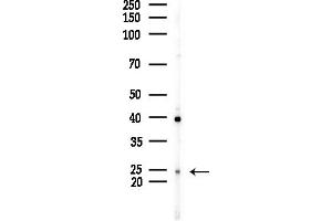 anti-Cyclin-Dependent Kinase Inhibitor 3 (CDKN3) (Internal Region) antibody