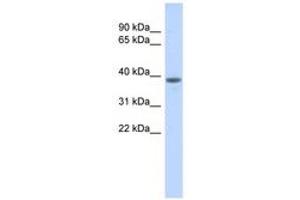 Image no. 1 for anti-DDB1 and CUL4 Associated Factor 4-Like 1 (DCAF4L1) (AA 323-372) antibody (ABIN6741260) (DCAF4L1 抗体  (AA 323-372))