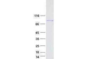 Western Blotting (WB) image for Zyxin (ZYX) (Transcript Variant 2) protein (Myc-DYKDDDDK Tag) (ABIN2736195)