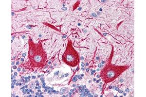 Anti-SLC15A1 antibody IHC of human brain, cerebellum. (SLC15A1 抗体  (C-Term))