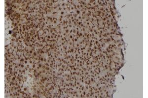 ABIN6277430 at 1/100 staining Rat liver tissue by IHC-P. (RAD52 抗体  (Internal Region))