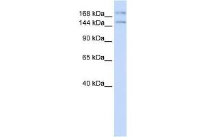 WB Suggested Anti-IFT140 Antibody Titration:  0. (IFT140 抗体  (N-Term))