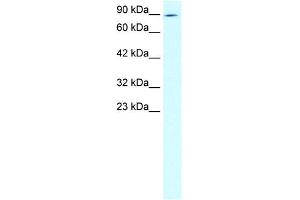WB Suggested Anti-ZNF341 Antibody Titration: 2. (ZNF341 抗体  (N-Term))