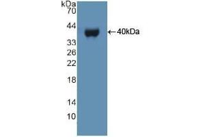 Detection of Recombinant UBE3A, Human using Polyclonal Antibody to Ubiquitin Protein Ligase E3A (UBE3A) (ube3a 抗体  (AA 158-407))