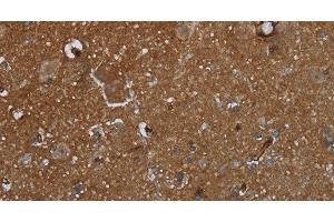 Immunohistochemistry of paraffin-embedded Human brain using GALT Polyclonal Antibody at dilution of 1:30 (GALT 抗体)