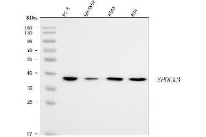 Western blot analysis of SPOCK3 using anti-SPOCK3 antibody (ABIN7599655).