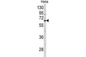 Western blot analysis of CTPS2 Antibody (N-term) in Hela cell line lysates (35ug/lane). (CTPS2 抗体  (N-Term))