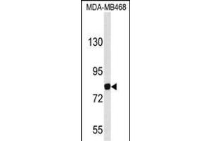 Western blot analysis of EVI5 Antibody (N-term) (ABIN653115 and ABIN2842698) in MDA-M cell line lysates (35 μg/lane). (EVI5 抗体  (N-Term))