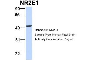 Host:  Rabbit  Target Name:  NR2E1  Sample Type:  Human Fetal Brain  Antibody Dilution:  1. (NR2E1 抗体  (Middle Region))
