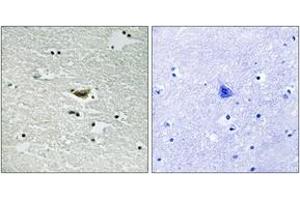 Immunohistochemistry analysis of paraffin-embedded human brain, using CK-1 alpha (Phospho-Tyr294) Antibody.
