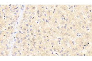 Immunohistochemistry (IHC) image for anti-Cysteine Dioxygenase, Type I (CDO1) (AA 1-200) antibody (ABIN7443176)