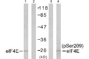 Western blot analysis of extracts from NIH/3T3 cells untreated or treated with FBS, using elF4E (Ab-209) antibody (Line 1 and 2) and elF4E (Phospho- Ser209) antibody (Line 3 and 4).